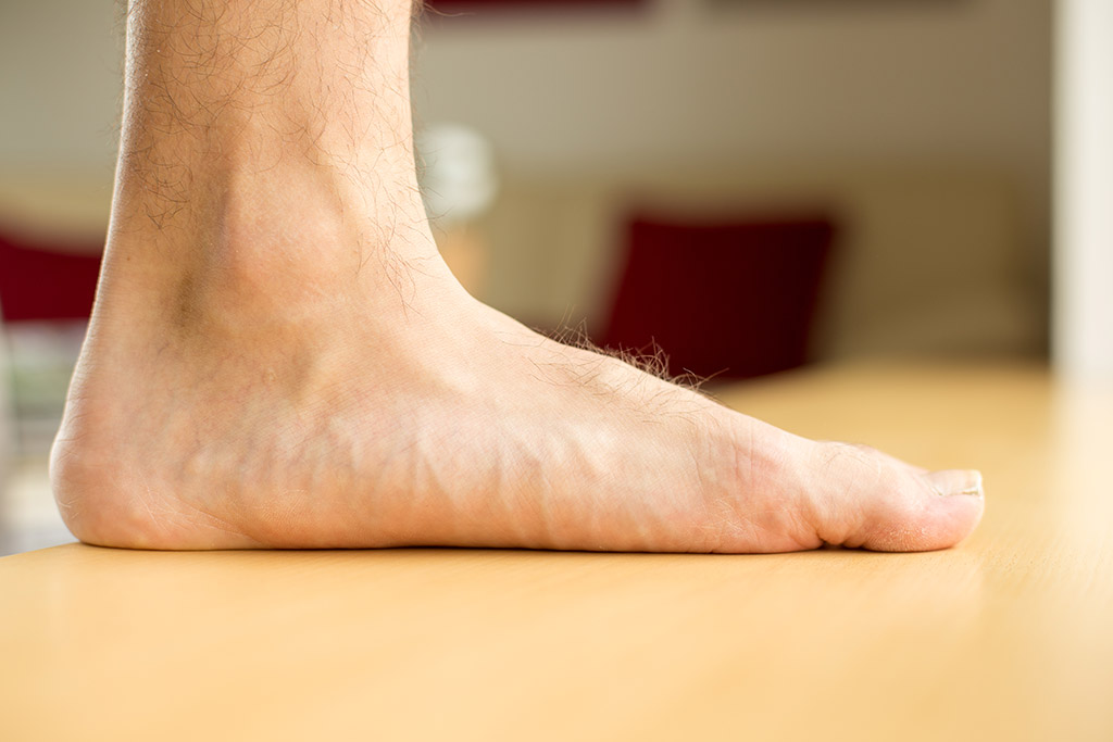 douleur pied plat douleur pied plat